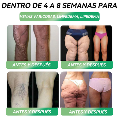 🏆Tienda Oficial | 𝙃𝐻𝑉𝖡®✨𝑺𝒐𝒍𝒖𝒄𝒊ó𝒏 𝒐𝒓𝒂𝒍 𝒍í𝒒𝒖𝒊𝒅𝒂 𝑮𝑳𝑷-1 𝒔𝒆𝒊𝒔 𝒆𝒏 𝒖𝒏𝒐 (Solo una dosis al día, cambios visibles en 7 días) 🌿 Para obesidad, salud cardiovascular, diabetes, apnea del sueño, problemas articulares y más